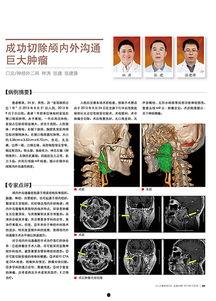脑科肿瘤爆料案例最新,最新爆料揭示治疗挑战与希望  第1张
